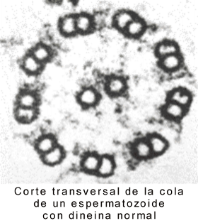 Fig. 6.10 (b) Microfotografías electrónicas del flagelo de un espermatozoide normal y con dineína defectuosa