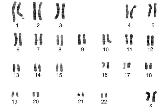 Fig. 10.17 - Cariotipo femenino normal