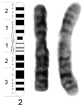 Fig. 10.18 - Idiograma del cariotipo humano masculino